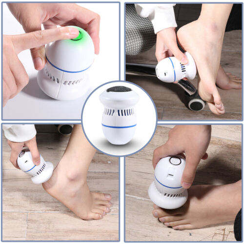 Removedor de Callos Eléctrico para Pies - PureTouch®