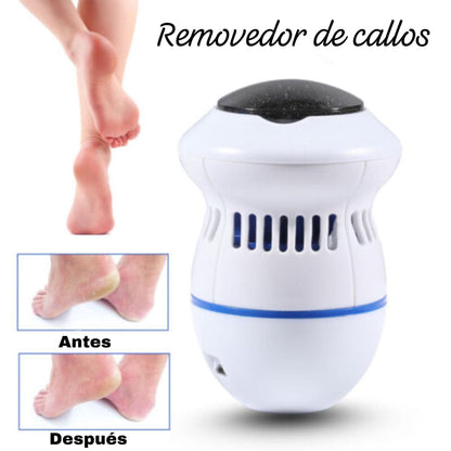 Removedor de Callos Eléctrico para Pies - PureTouch®